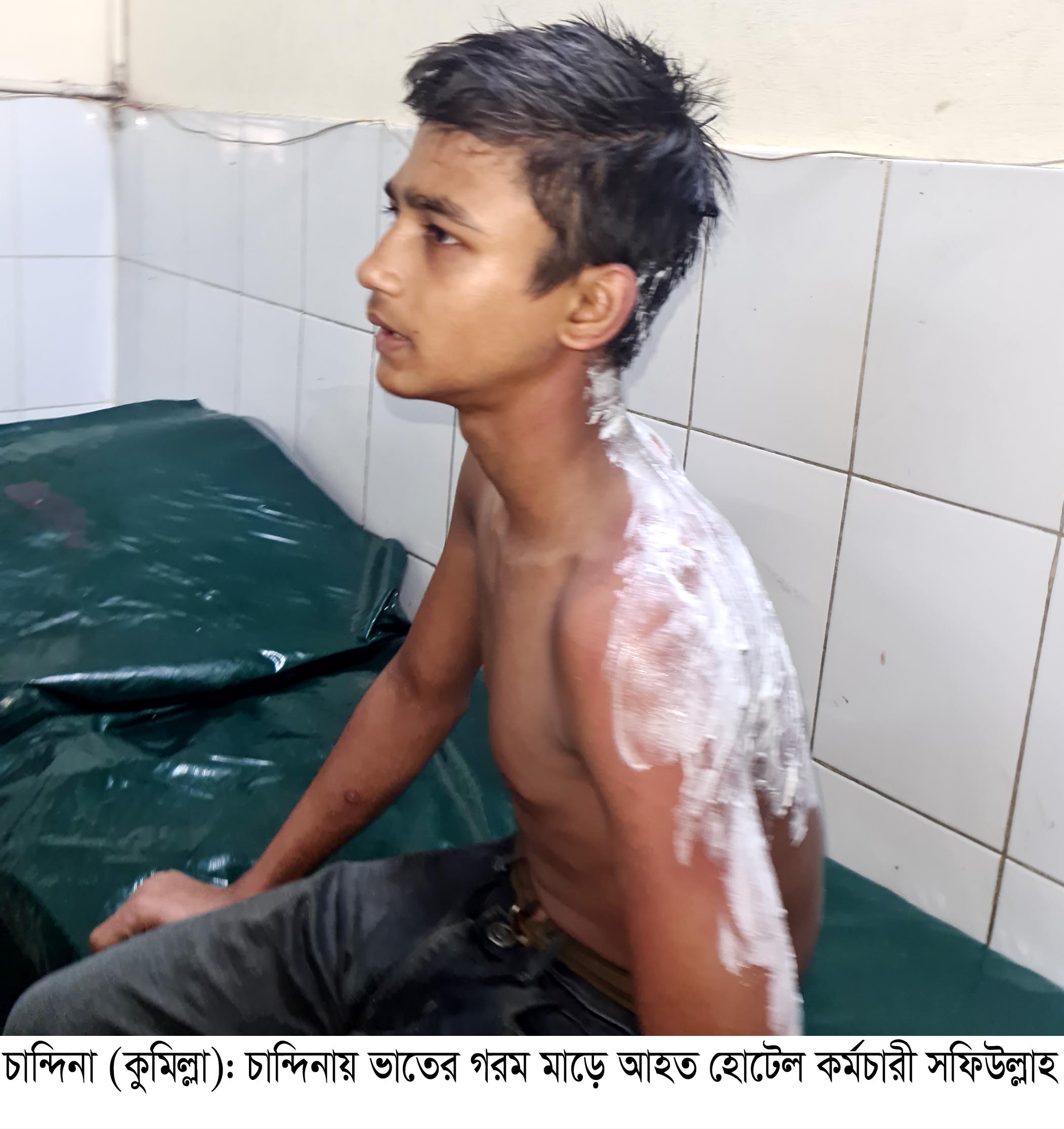 কিশোর কর্মচারীর গায়ে ভাতের গরম মাড় ঢেলে দিল বাবুর্চি