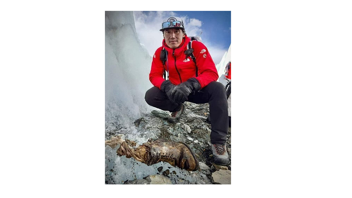 আরভিনের পা