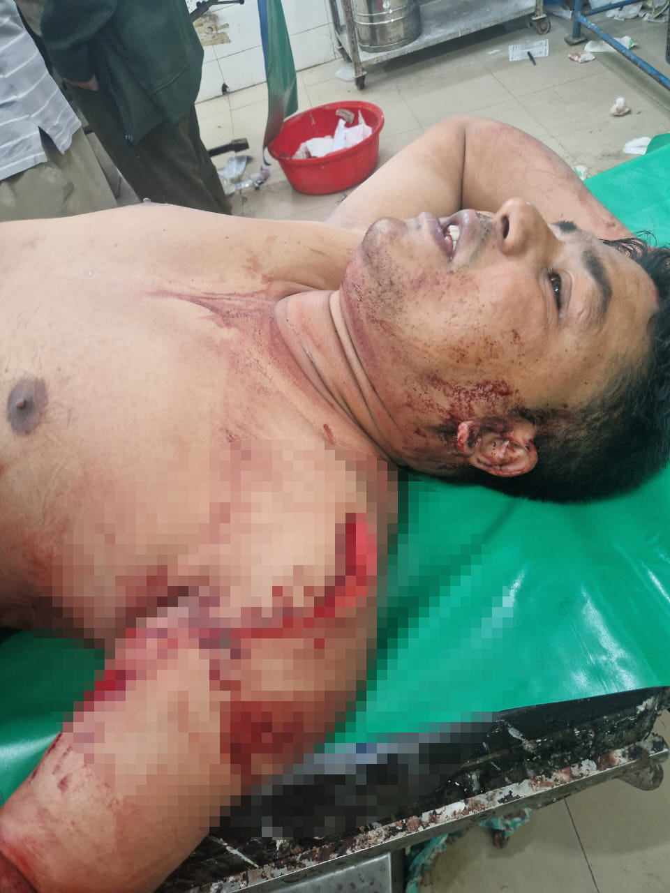 কুমিল্লায় যুবদল নেতাকে ছুরিকাঘাত