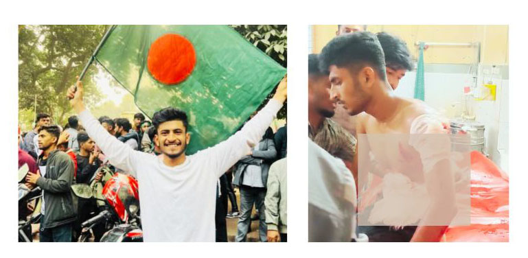 দেবীদ্বারে কিশোরগ্যাং’র চাপাতির কুপে কিশোর আহত
