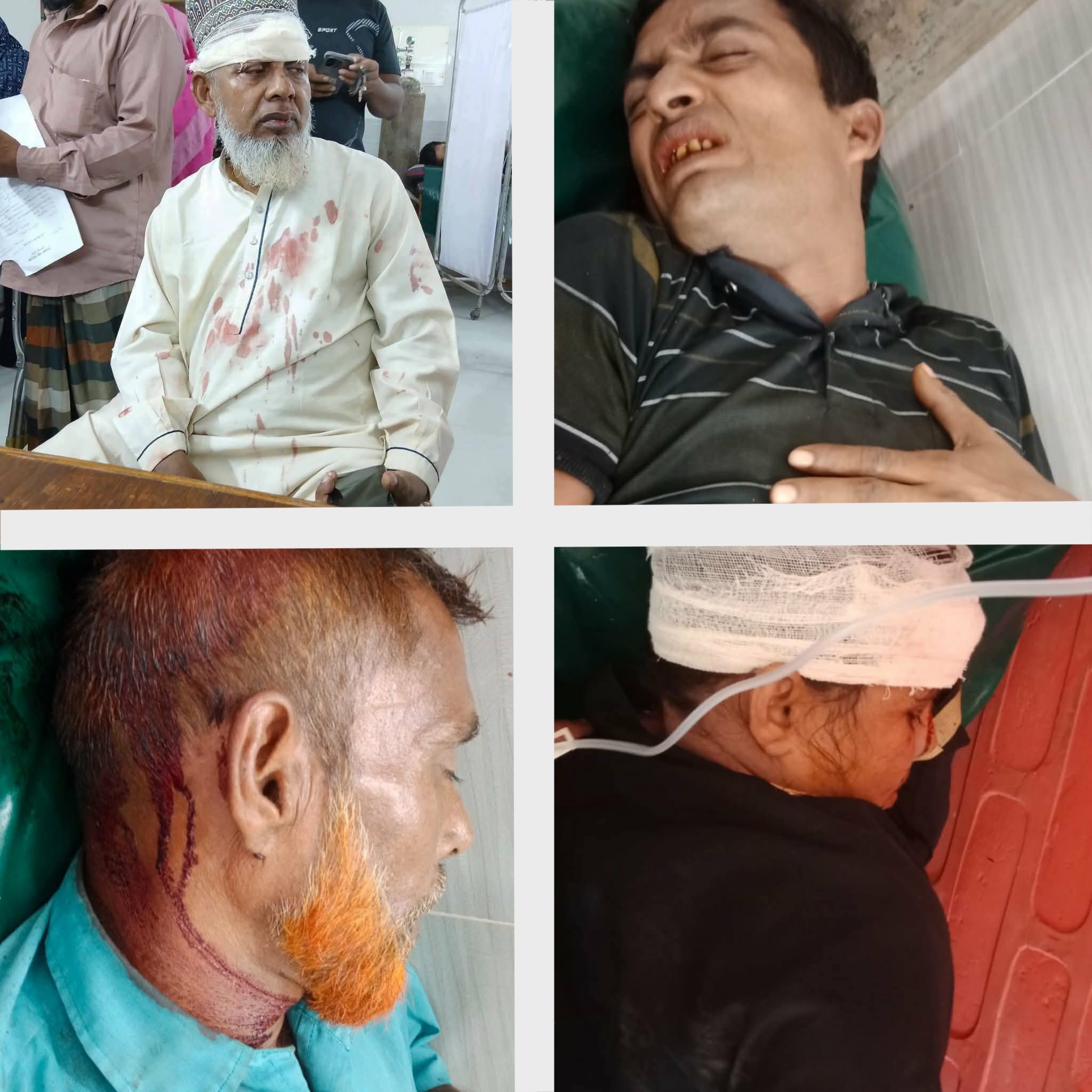 ব্রাহ্মণপাড়ায় দুই যানবাহনের মুখোমুখি সংঘর্ষে ৭ যাত্রী গুরুতর আহত