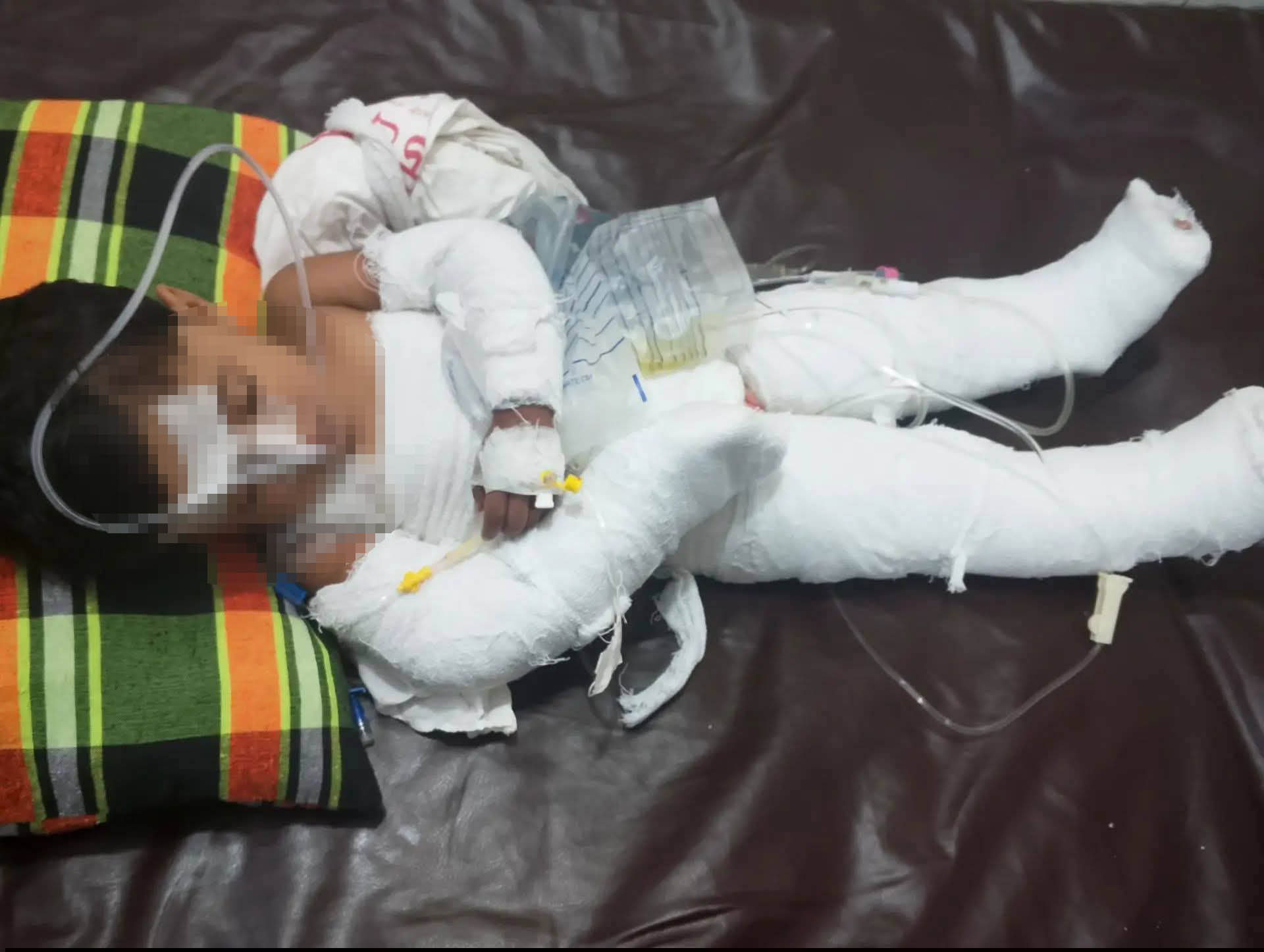 গরম পানিতে পড়ে শিশুর মৃত্যু