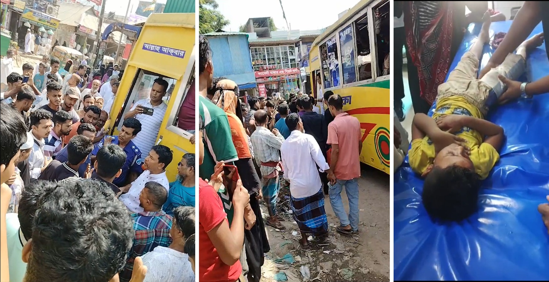 বরুড়ায় বলাকা বাসের ধাক্কায় সাত বছরের শিশুর পা ভেঙে গেছে
