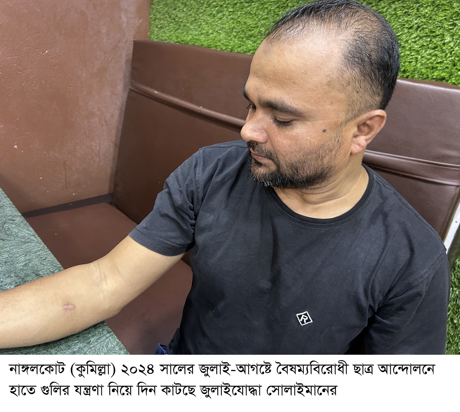 শরীরে একাধিক গুলি নিয়ে যন্ত্রণায় দিন কাটাচ্ছেন  জুলাইযোদ্ধা সোলাইমান