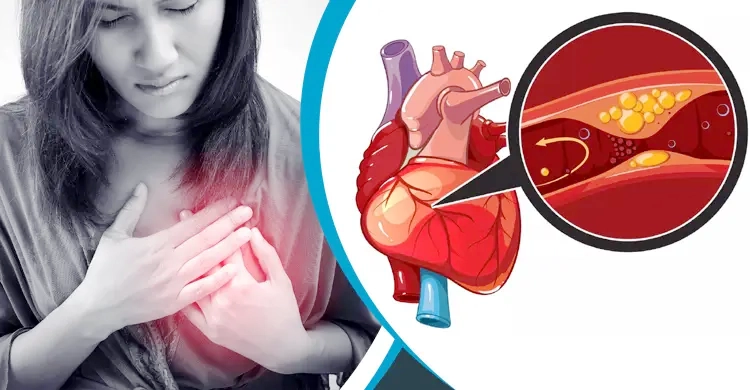 তরুণদের হার্ট অ্যাটাকের ঝুকির কারণ